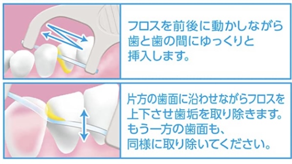 歯の間が狭くて糸ようじがすぐ切れてしまう人向けオススメフロス